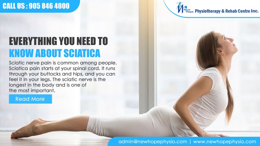 What You Need to Know About Sciatica